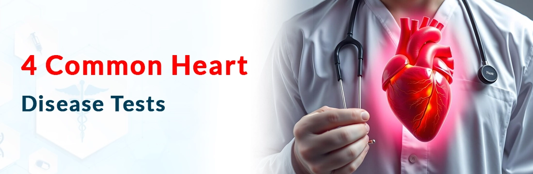 4 Common Heart Disease Tests